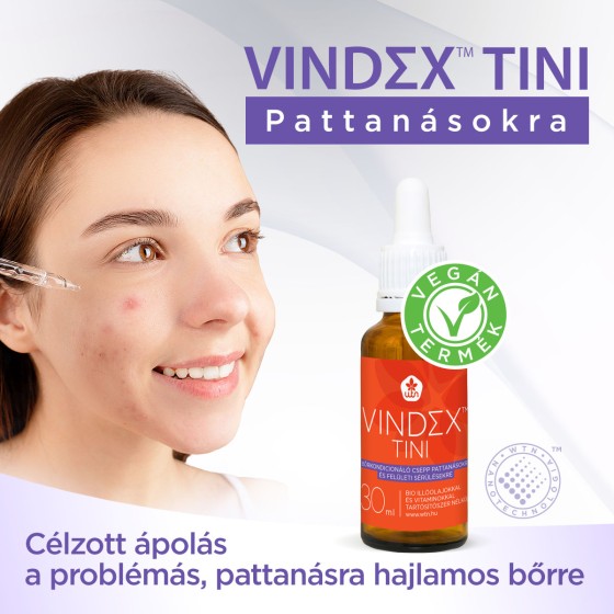 WTN Vindex™ Tini