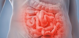 Az emberi mikrobiom és az egészségét támogató étrend 2. rész