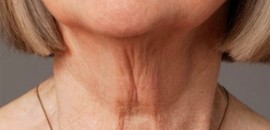 A hormonok és az öregedéssel járó hangváltozás összefüggései