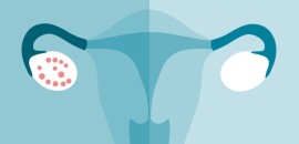 A PCOS (Policisztás Ovárium Szindróma) kialakulásának okai és hatása a szervezetre 2. rész