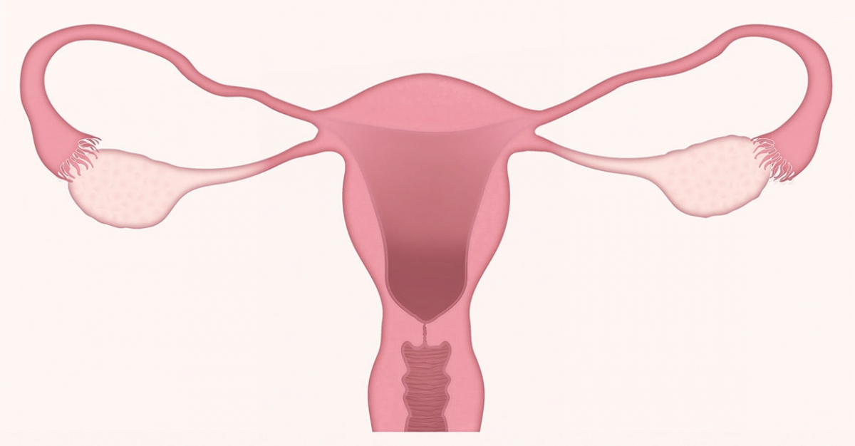 A szabálytalan menstruációs ciklus hatása a fogantatásra